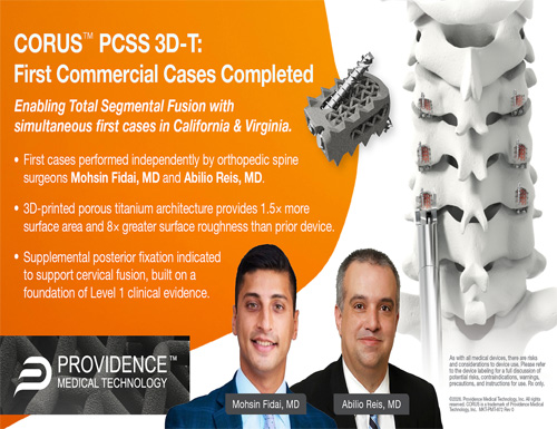 CORUS&trade; PCSS 3D-T 