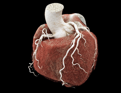 Memorial Brings the Future of Heart Imaging to South Florida