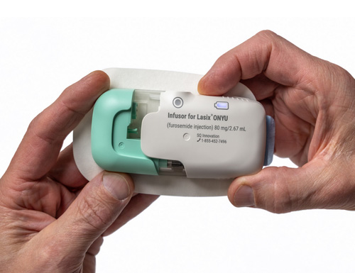 Trial Results Demonstrate Subcutaneous Furosemide as a Viable Alternative to Hospitalization for Heart Failure Edema Treatment