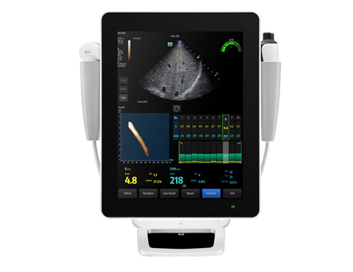 The Newly Expanded Hepatus-Series Ultrasound Systems Lead the Evolution of Gastroenterology Imaging by Mindray