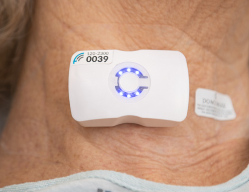 Sutter Health Expands Wearable Ultrasound Technology to More Bay Area Hospitals for Sepsis Care