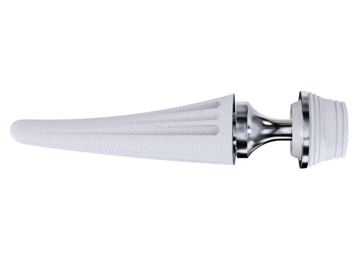 TOUCH prosthesis