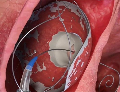 Allmed Solutions Achieves Milestone with 