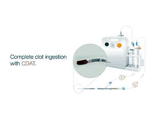 Imperative Care Debuts New Stroke Treatment Innovation, Treats First Patients Using Continuous Dual Aspiration