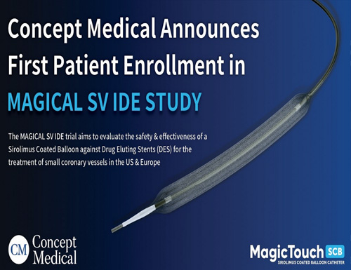 Concept Medical announces the first patient enrollment in the MAGICAL-SV IDE trial, expanding its coronary clinical program across the U.S. and Europe