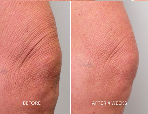 Doctor Rogers Skin Care Announces the Launch of 'Laser in a Bottle' Body Repair Treatment for the Body
