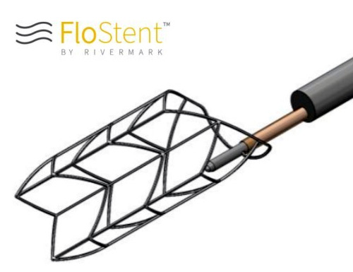 Rivermark Medical Announces Enrollment of First Patient in RAPID III Clinical Study Evaluating the Flostent™ System