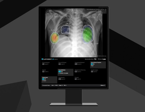 Lunit Debuts Next-Gen INSIGHT CXR4, Backed by CE MDR Approval for Advanced AI Diagnostic Capabilities