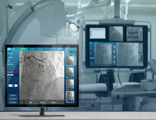 Terumo and MedHub-AI partner to market FFR technology based on AI in Japan