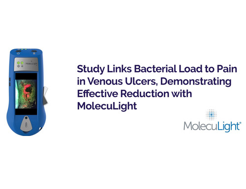 Study Finds Bacterial Load Linked to Pain in Venous Ulcers, Reduced Effectively with MolecuLight