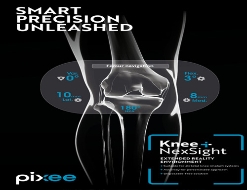 FDA 510(k) Clearance is Received by Pixee Medical for its Augmented Reality Solution Tailored to U.S. Ambulatory Surgery Centers