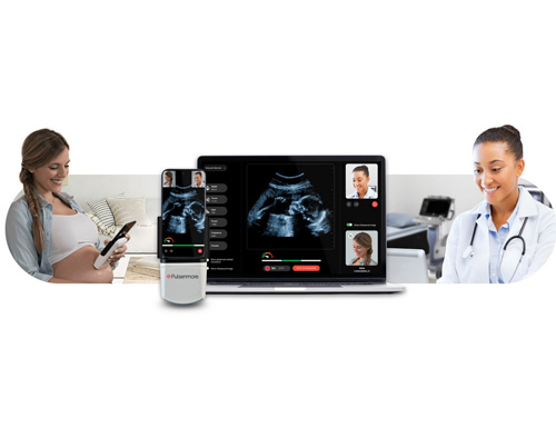 Pulsenmore Receives FDA De Novo Marketing Authorization for Home-Use Prenatal Ultrasound, Pioneering a New Era in U.S. Prenatal Care