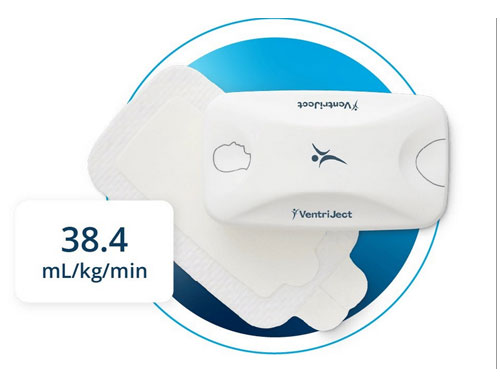 To advance preventive care, EHE Health introduces its new VO2 Max innovation.