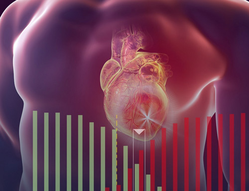 Ultromics Enhances HFpEF Diagnosis with AI-Powered Probability Scoring on EchoGo®