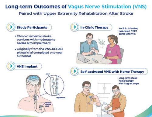 Vivistim Therapy Helps Chronic Stroke Survivors Demonstrate Long-Term Improvement in Motor Impairment
