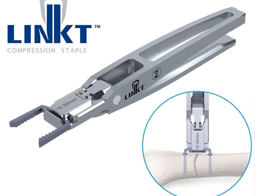 FDA 510(k) Clearance Granted to Trax Surgical for Nitinol Staple System